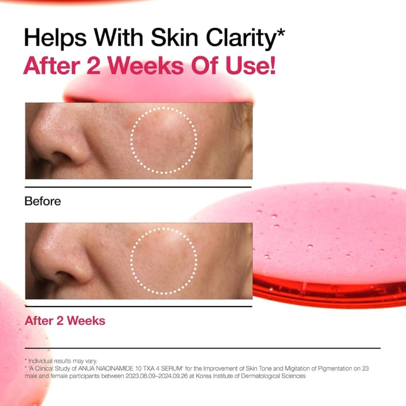 ANUA Niacinamide 10 + TXA 4 Serum, Hyaluronic Acid, Tranexamic acid, Vitamin B12, Facial Serum for Glass Skin, Clarifying, Radiant Complexion with Natural Color, Korean Skin Care