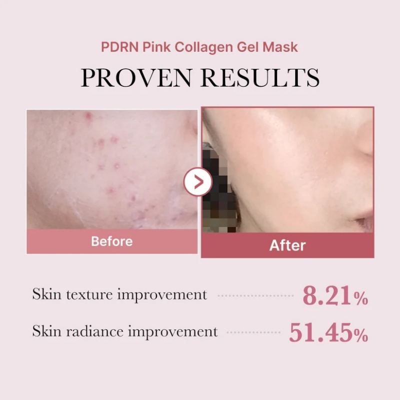 Medicube Salmon DNA PDRN pink collagen jelly gel mask | overnight face mask for glass glow skin- elasticity, hydrating, firming and moisturizing | korean skincare