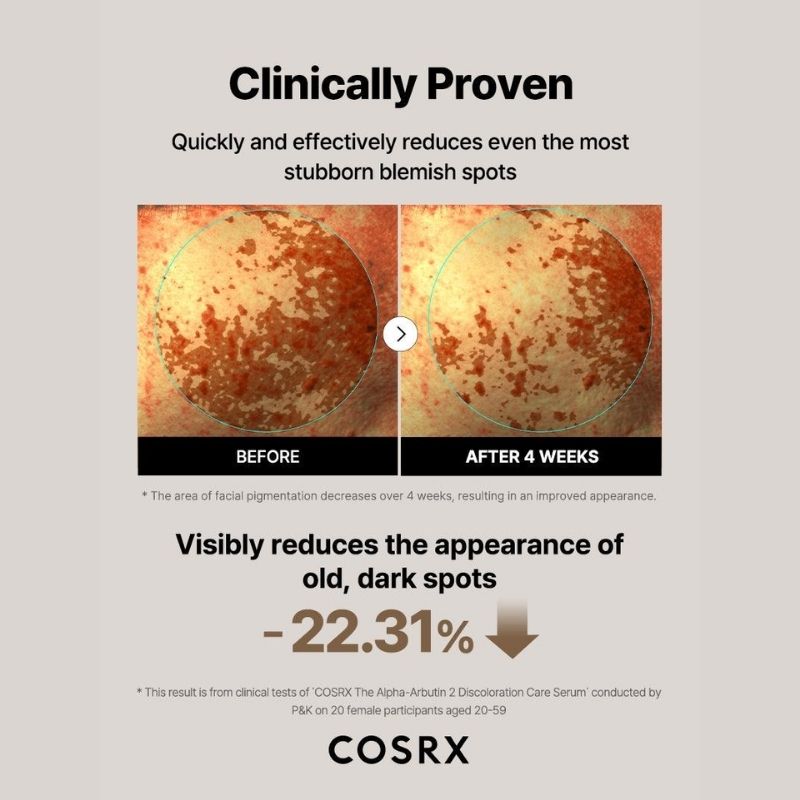 COSRX Alpha-Arbutin 2% Discoloration Serum, Melanin Treatment Face Serum with Niacinamide 5% & Hyauronic Acid, Clinically Tested, Korean Skincare