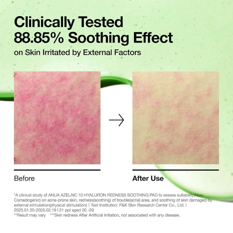 Anua Azelaic 10 Hyaluron Redness Soothing Pad, Troubled & Spot Care with Korean toner pads, Quick & Easy Stretchable Facial Mask with Azelaic acid, Hyaluronic Acid, Korean Skin Care (90 pads) Cyprus Anua