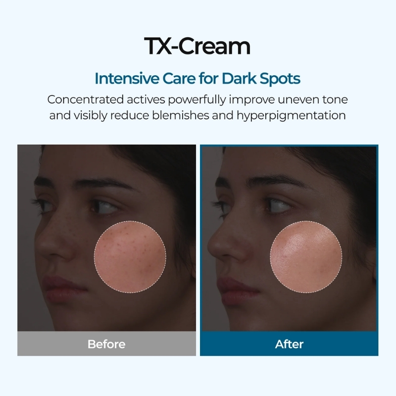 Dr. Melaxin TX Tranexamic Acid CREAM | Skin freckle Cream, Blemishes, Anti-pigmetation korean skin care | Korean Cosmetics | 50ml, Dr. Melaxin Cyprus