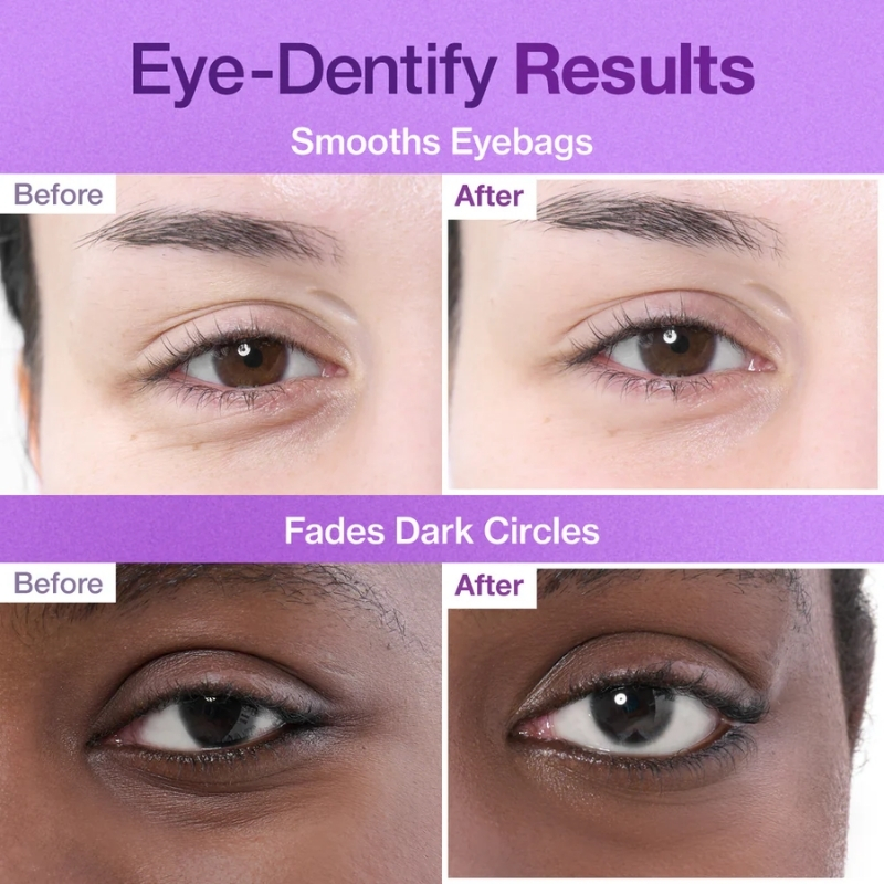 numbuzin No.9 Eye Patches | NAD+ Collagen Under Eye Patches | Dark Circles, Cooling, Puffy Eyes, Eyebags, Wrinkles | Peptides, Caffeine, Niacinamide | Self Care, Gift | 5 Pairs, Numbuzin Cyprus, No.9 NAD+ Collagen Under Eye Patches (5 Pairs)