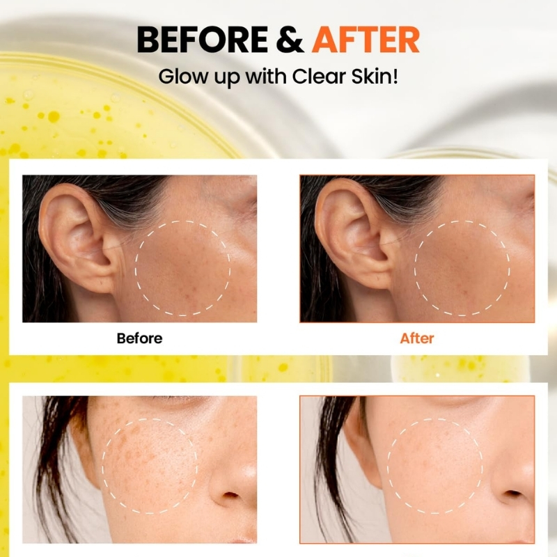 ksecret SEOUL 1988 GLOW SERUM : NIACINAMIDE 15% + YUJA