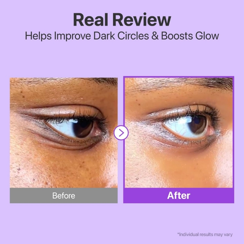 Numbuzin - No.9 NAD+ Retinol Volumetox Eye Cream 10ml - Image 8