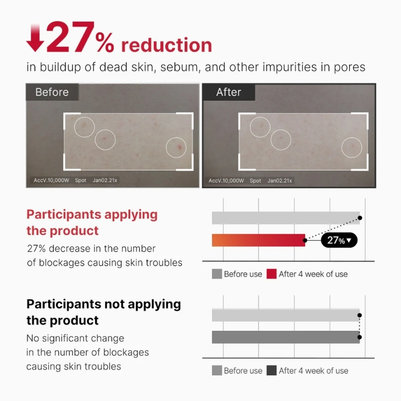 Infographic: 27% reduction in dead skin and impurities; side-by-side Before and After skin images, showing fewer blockages after 4 weeks of use; two bar charts compare grayscale 'Before use' vs red 'After 4 weeks of use' with notes on participants applying or not applying the product.