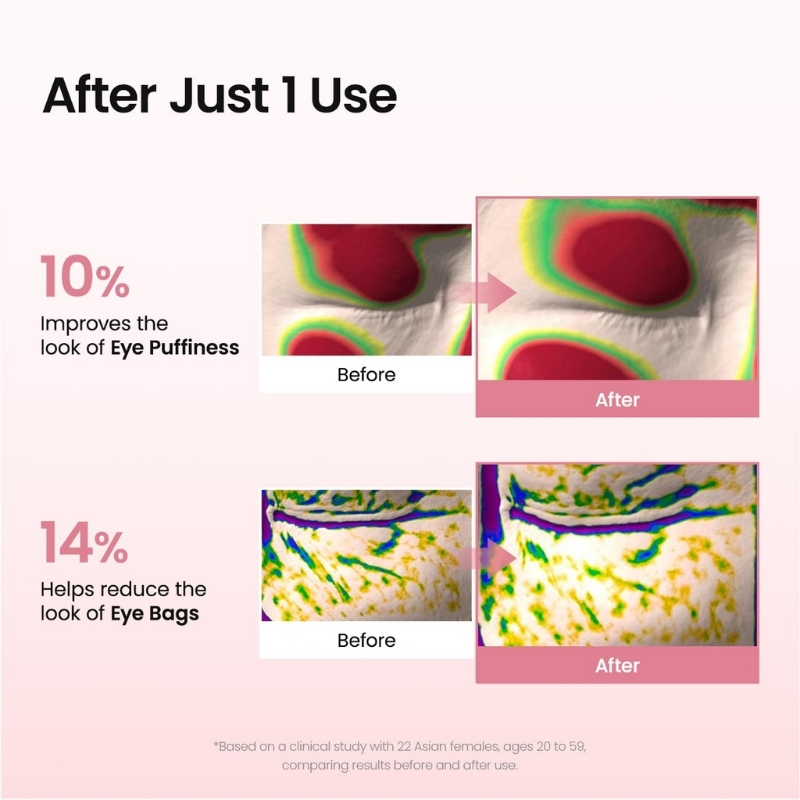 Infographic showing after one use improves eye puffiness by 10% and reduces eye bags by 14%, with before and after images.