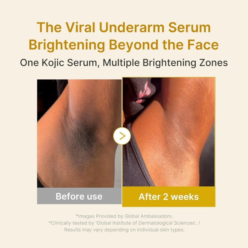 Infographic showing underarm brightening results: left panel 'Before use' with dark underarm, right panel 'After 2 weeks' with lighter skin; title above.