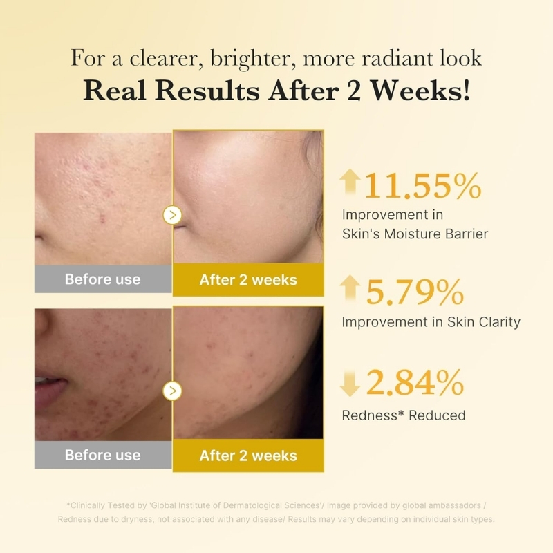 Two-panel skincare before/after comparison after 2 weeks: left 'Before use', right 'After 2 weeks' with metrics—11.55% moisture barrier, 5.79% clarity, 2.84% redness reduced.