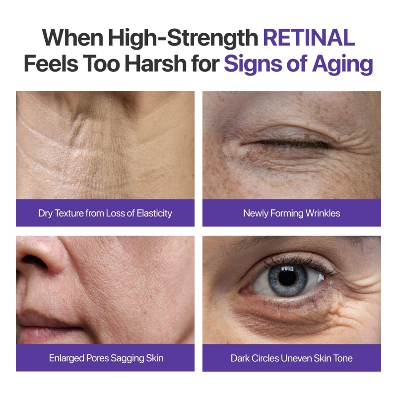 Infographic about eye-area aging signs: dry texture from loss of elasticity; newly forming wrinkles; enlarged pores with sagging skin; and dark circles with uneven skin tone.
