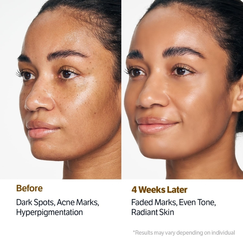 Side-by-side portrait showing skin improvement: left panel 'Before' with dark spots and hyperpigmentation; right panel '4 Weeks Later' with radiant, even-toned skin.