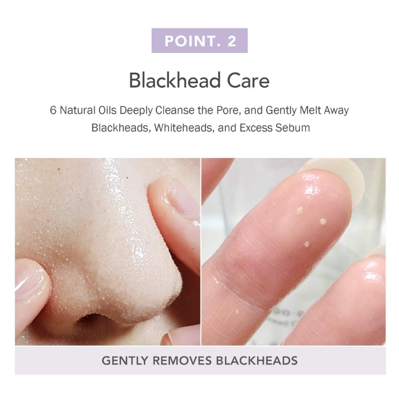 Infographic slide 'Point. 2 Blackhead Care' showing a close-up of a nose with visible pores on the left and a fingertip with a small whitehead on the right, captioned 'Gently removes blackheads'