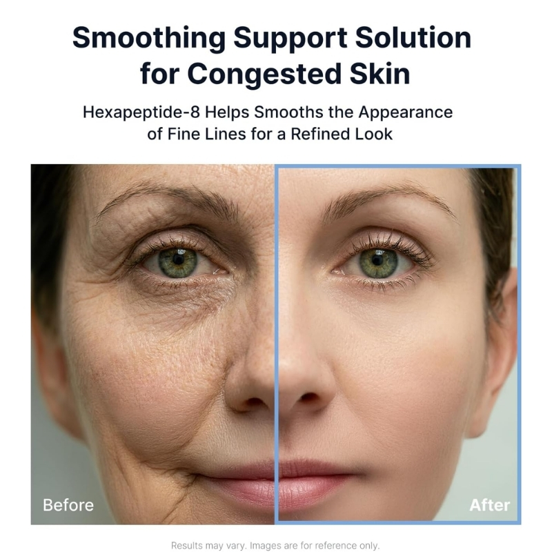 Split-face skincare comparison showing aging left with wrinkles and smoother right after treatment labeled Before and After.