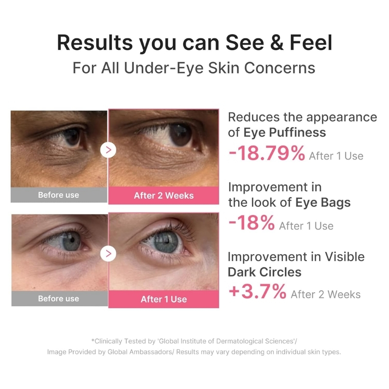 Infographic showing before/after close-ups of under-eye skin with results: reduced puffiness, fewer bags, and lighter dark circles after use (percent improvements shown).
