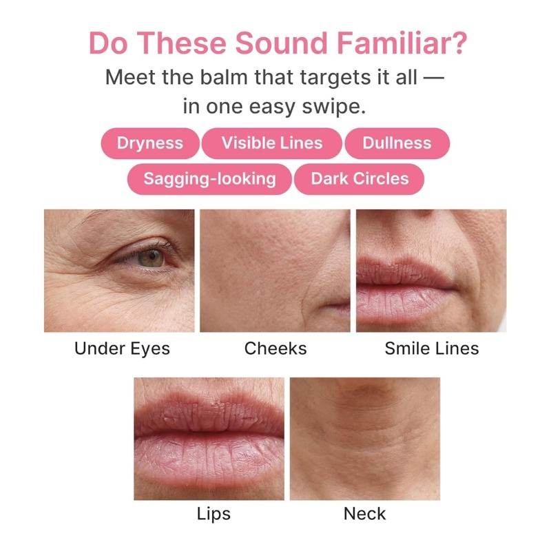 Infographic about facial aging signs, highlighting under eyes, cheeks, smile lines, lips, and neck with close-up photos.